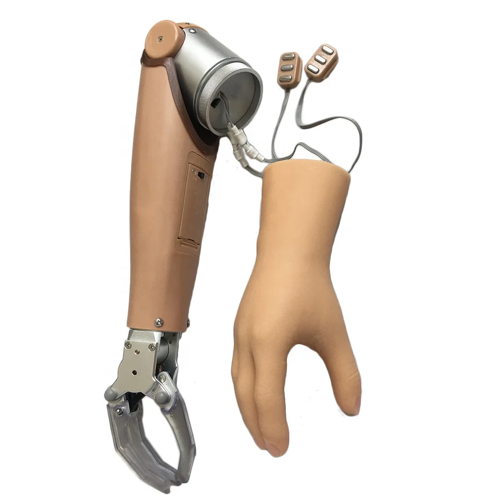 Myoelectric Arm Prostheses With Two Degrees of Freedom for AE Prosthetic Hand - Image 6