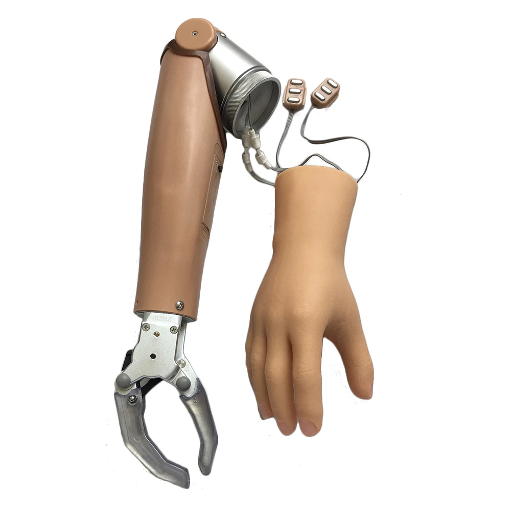Myoelectric Arm Prostheses With Two Degrees of Freedom for AE Prosthetic Hand - Image 2